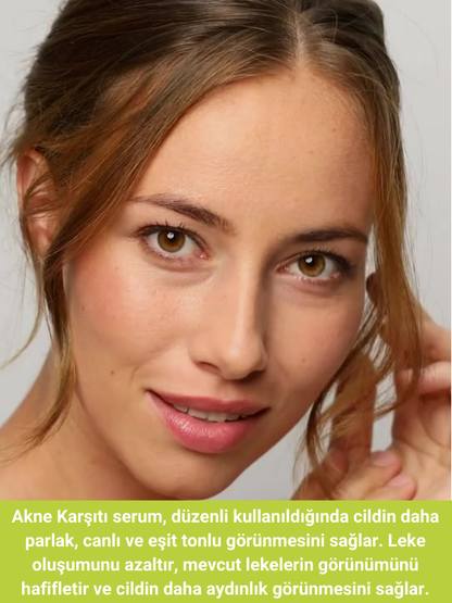 The Vivia Siyah Nokta, Sivilce ve Akne Karşıtı, Gözenek Sıklaştırıcı Cilt Serumu Pelargonium Niacinamide Hyaluronic Acid Panthenol 30 ml